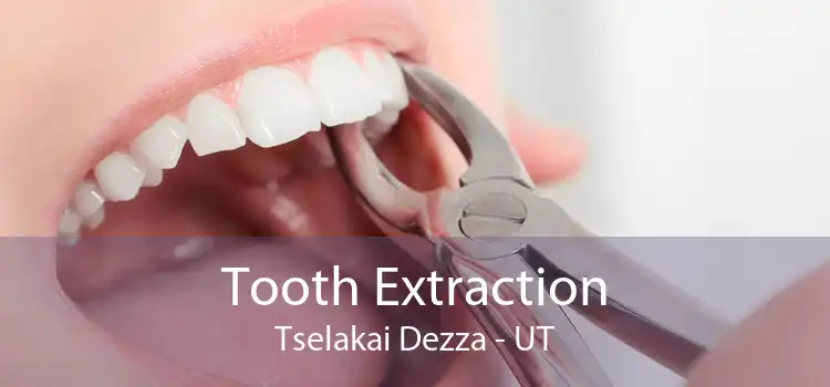 Tooth Extraction Tselakai Dezza - UT