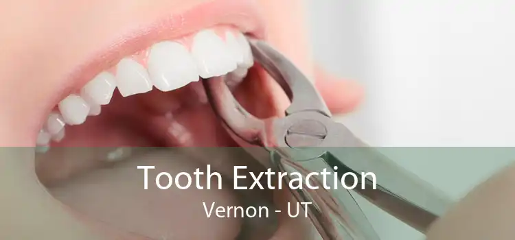 Tooth Extraction Vernon - UT