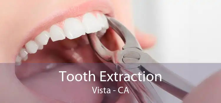 Tooth Extraction Vista - CA