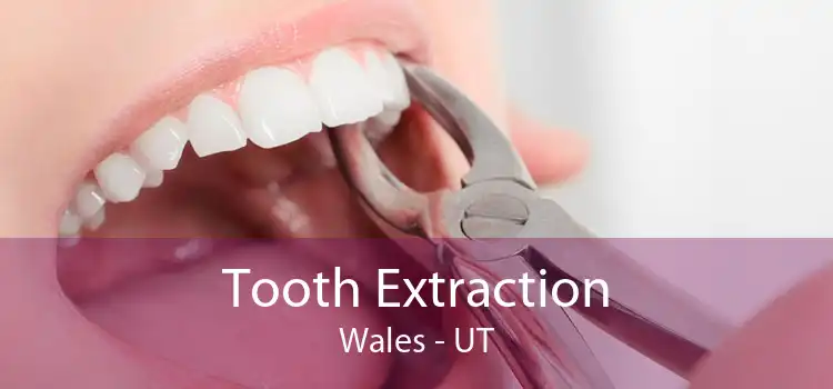 Tooth Extraction Wales - UT
