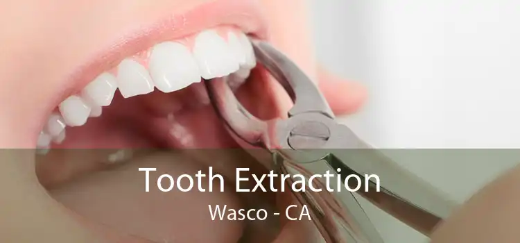 Tooth Extraction Wasco - CA
