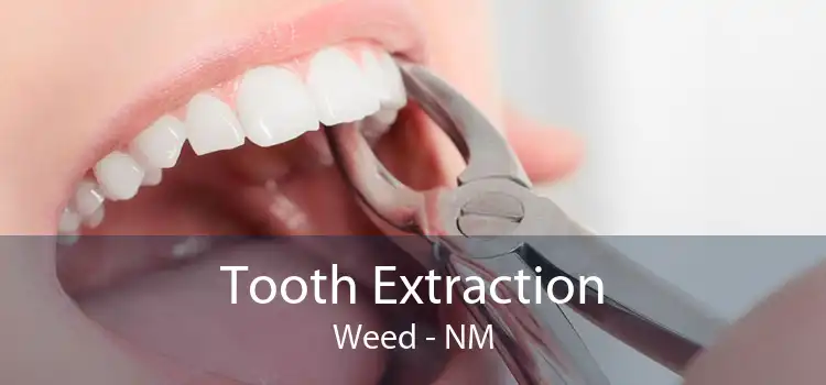 Tooth Extraction Weed - NM