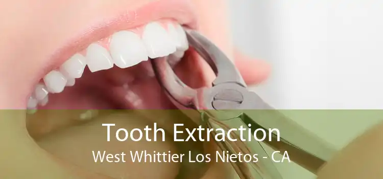 Tooth Extraction West Whittier Los Nietos - CA