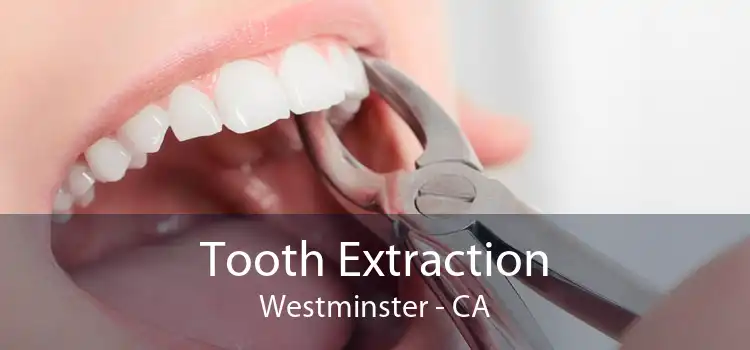 Tooth Extraction Westminster - CA