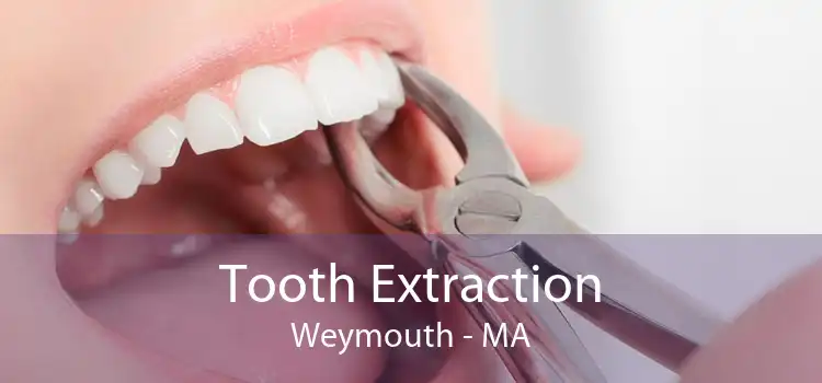 Tooth Extraction Weymouth - MA