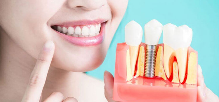 Dental Implants Near Me in Algonquin, IL