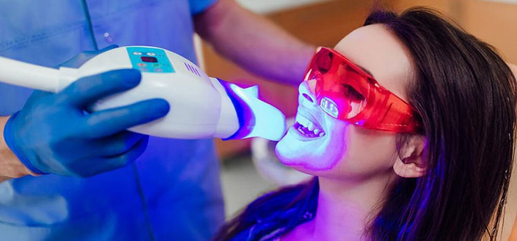 Teeth Whitening Near Me in Albany, OR